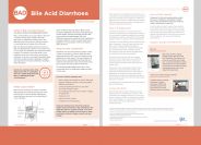 Bile acid diarrhoea (BAD) patient information sheet (English)